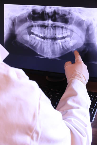 Best Emergency Gum Treatment in Dimmitt, TX