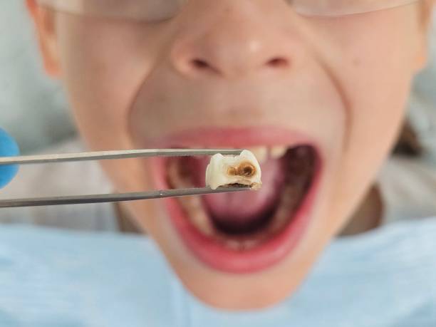 Best Same-Day Emergency Dental Services in Dimmitt, TX